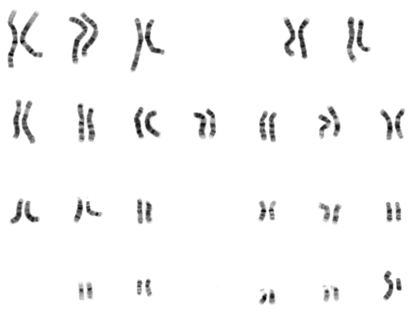 insan kromozomu 46 diploid