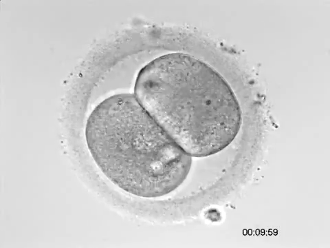 insan embriyosunun kabugundan cikmasi zona pellisuda kuran mucizeler